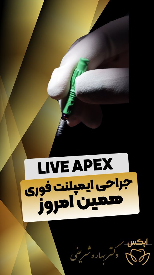 کاشت یک واحد ایمپلنت دیجیتال سوئیسی