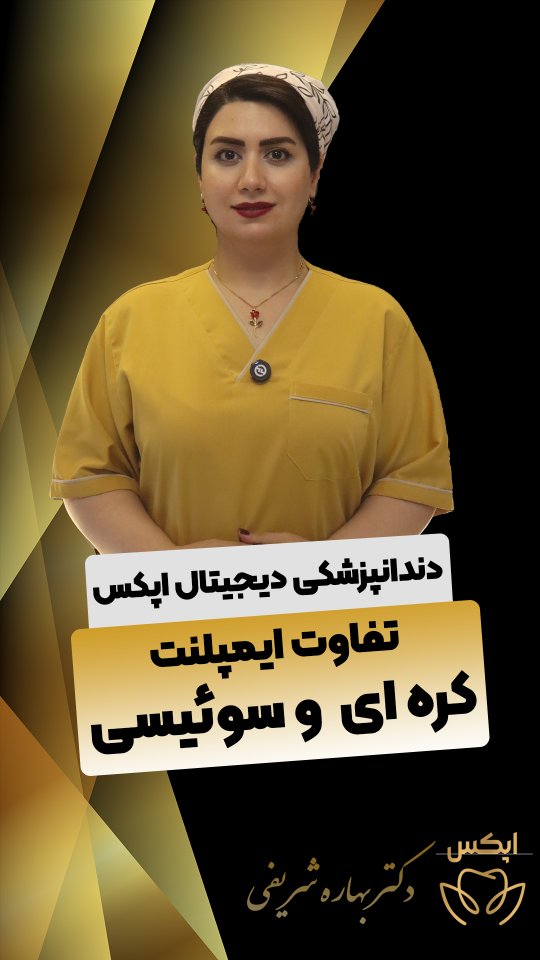 تفاوت ایمپلنت کره ای و ایمپلنت سوئیسی