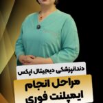 مراحل انجام ایمپلنت فوری در مجموعه اپکس